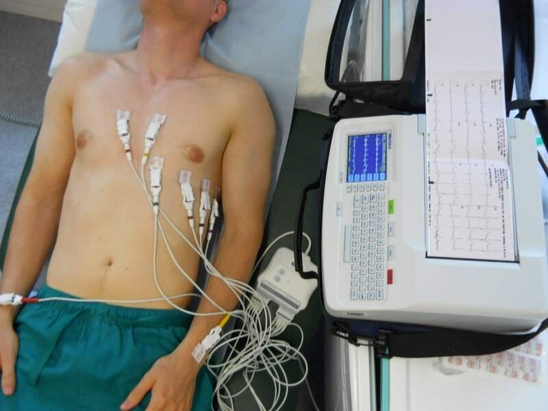 Administer Ekg